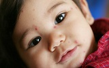 Chua benh thuy dau ava