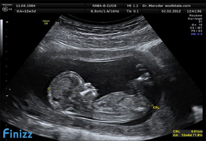 Image  5 