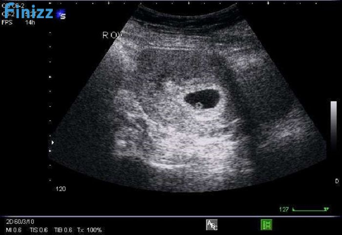 Image  4 