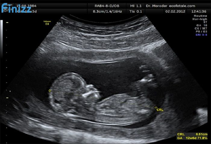 Image  1 